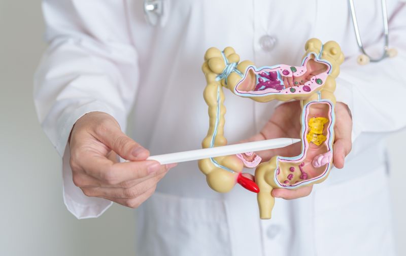 Doctor holding a model of the human colon and pointing to the intestines with a pen.