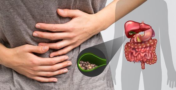Illustration showing gallstones in the gallbladder with a person holding their abdomen in pain.